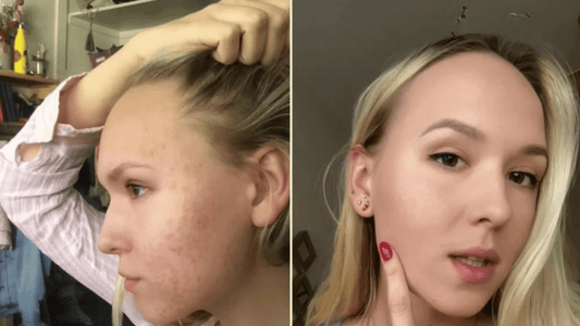 Skincare with sensitive skin in mind | OMIANA